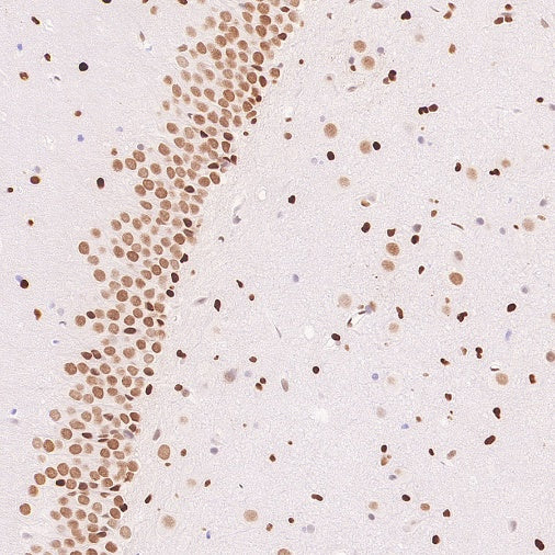 Cleaved Caspase-3 (Asp175) Recombinant Rabbit mAb (S-1406-409)