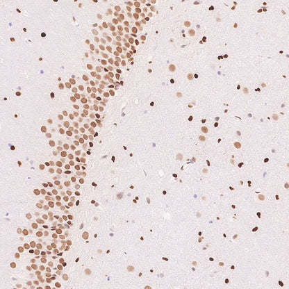 Cleaved Caspase-3 (Asp175) Recombinant Rabbit mAb (S-1406-409)