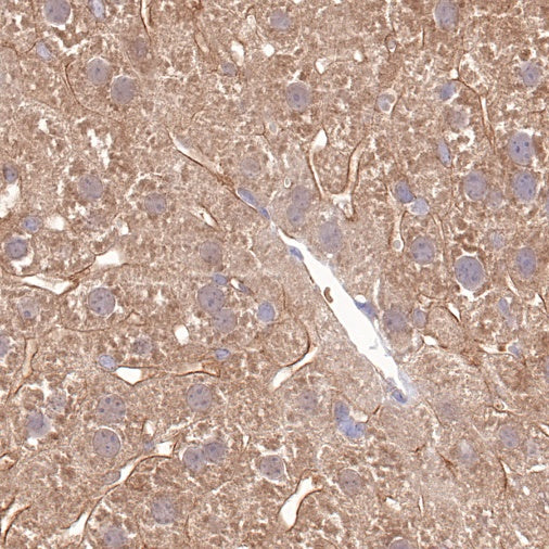 COX2 Recombinant Rabbit mAb (S-870-18)