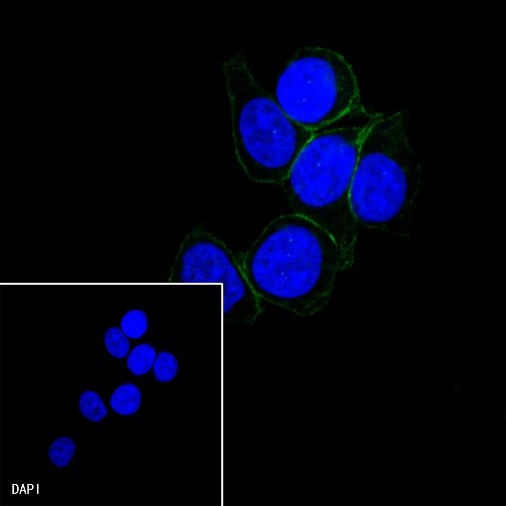 E-Cadherin Recombinant Rabbit mAb (SDT-438-45)