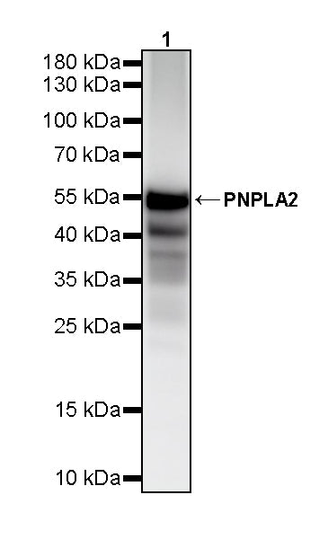 PNPLA2 Recombinant Rabbit mAb (S-5409)
