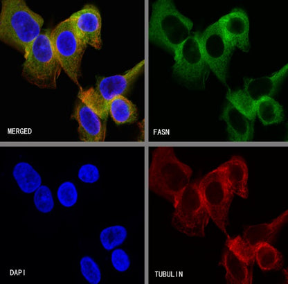 FASN Recombinant Rabbit mAb (S-682-32)
