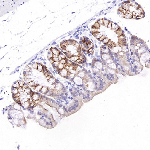 SLC12A2 Recombinant Rabbit mAb (S-2437-30)