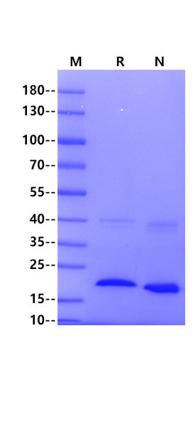 IL-37b/IL-1F7b His Tag Protein, Human