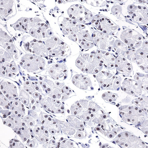 Histone H3 (mono methyl K4) Rabbit polyclonal antibody