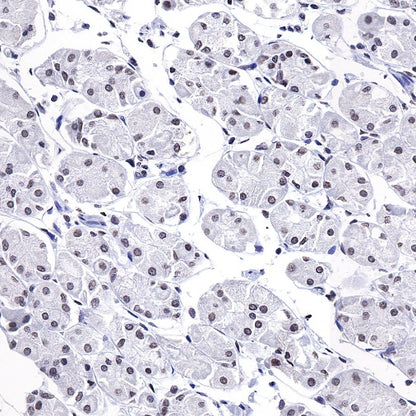 Histone H3 (mono methyl K4) Rabbit polyclonal antibody