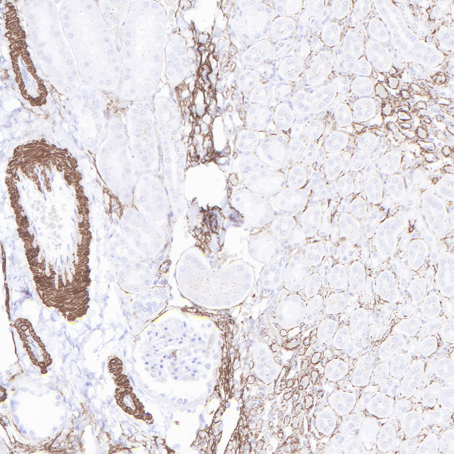 S-RMab® alpha smooth muscle Actin (SMA) Recombinant Rabbit mAb (SDT-301-142)
