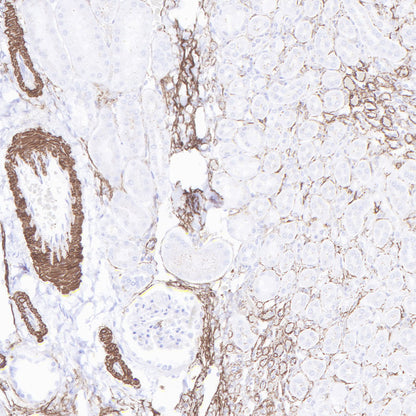S-RMab® alpha smooth muscle Actin (SMA) Recombinant Rabbit mAb (SDT-301-142)