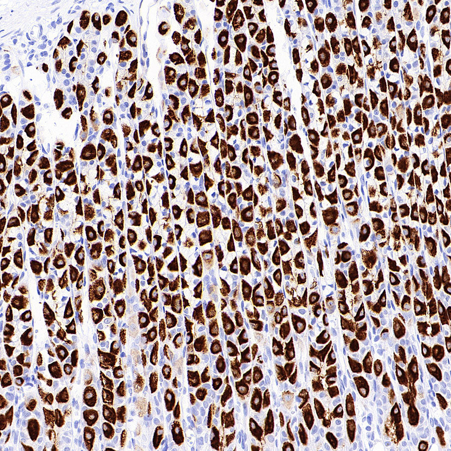 H+/K+-ATPase Recombinant Rabbit mAb (S-3474-110)