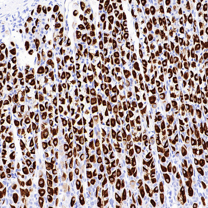H+/K+-ATPase Recombinant Rabbit mAb (S-3474-110)