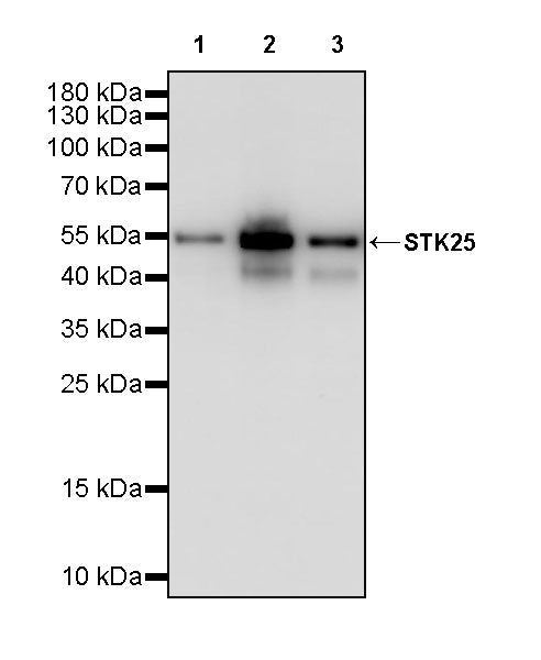 STK25 Recombinant Rabbit mAb (S-4088-17)
