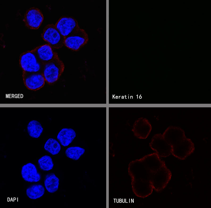 Keratin 16 Recombinant Rabbit mAb (S-R306)
