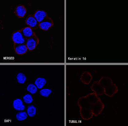 Keratin 16 Recombinant Rabbit mAb (S-R306)