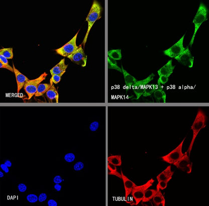 p38 delta/MAPK13 + p38 alpha/MAPK14 Recombinant Mouse mAb (S-3860)