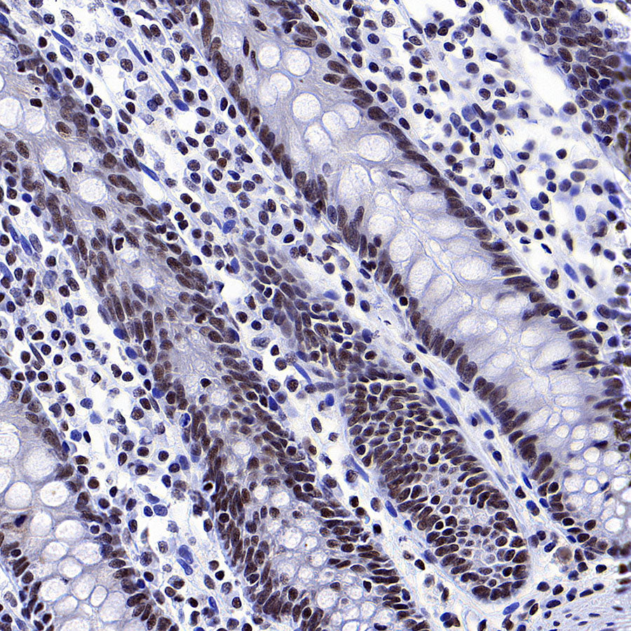YY1 Recombinant Rabbit mAb (S-3652-44)