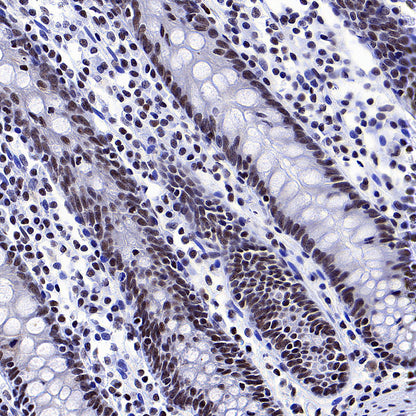 YY1 Recombinant Rabbit mAb (S-3652-44)