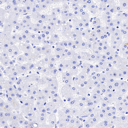 FAP Recombinant Rabbit mAb,PBS Only (SDT-R132)