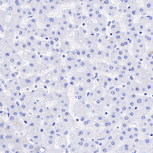FAP Recombinant Rabbit mAb,PBS Only (SDT-R132)