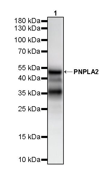 PNPLA2 Recombinant Rabbit mAb (S-5409)
