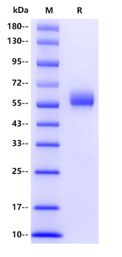 Bovine bPAG19 Protein, His tag