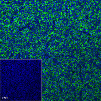 CD99 Recombinant Rabbit mAb (SDT-R122)