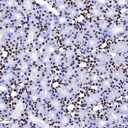 Histone H2B (mono methyl K5) Recombinant Rabbit mAb (S-1416-412)