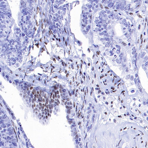 MeCP2 Recombinant Rabbit mAb (S-1884-28)