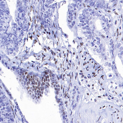 MeCP2 Recombinant Rabbit mAb (S-1884-28)