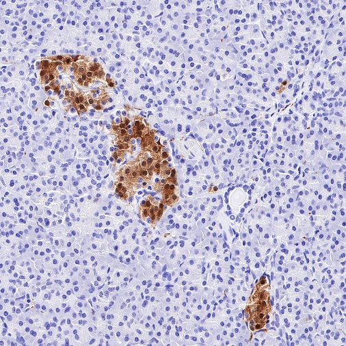 PGP9.5 Recombinant Rabbit mAb (SDT-665-37)