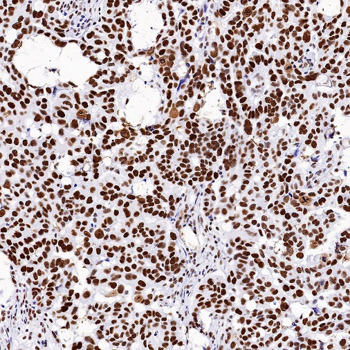 Nucleolin Rabbit Polyclonal Antibody
