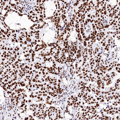 Nucleolin Rabbit Polyclonal Antibody