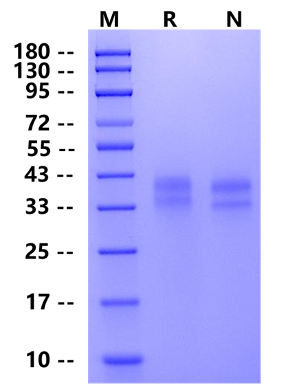 Biotinylated FOLR1 His&Avi Tag Protein, Mouse