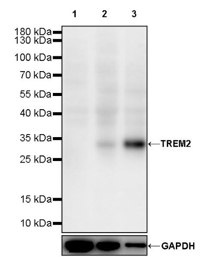 TREM2 Recombinant Rabbit mAb (S-1724-16)