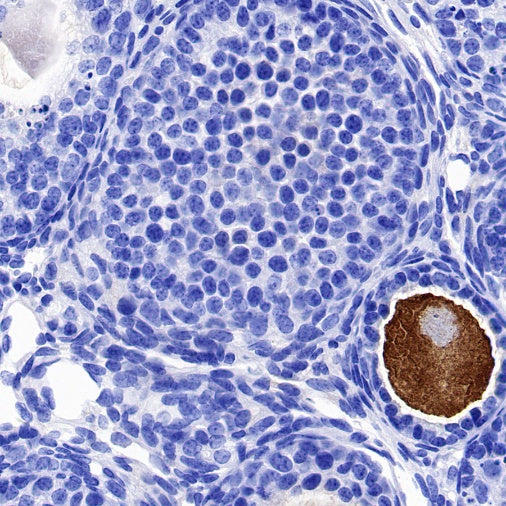 DDX4 Recombinant Rabbit mAb (S-1570-48)