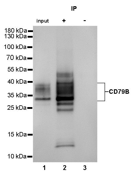 CD79B Recombinant Rabbit mAb(SDT-043-9)