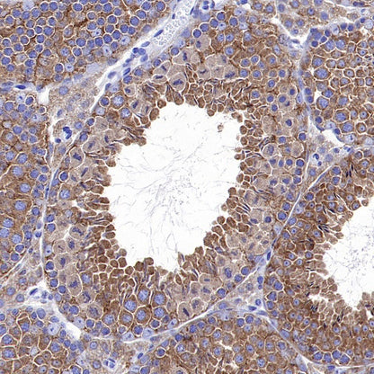 GSPT1 Recombinant Rabbit mAb (S-1914-49)
