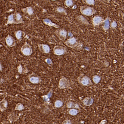 PKC zeta Recombinant Rabbit mAb (S-1306-34)
