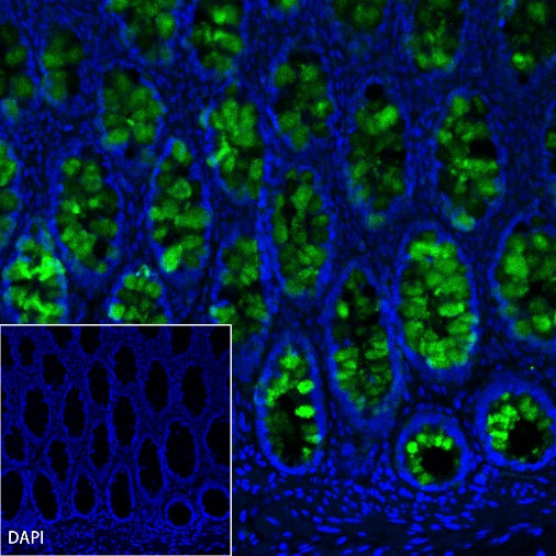 MUC5B Recombinant Rabbit mAb (SDT-2351-40)
