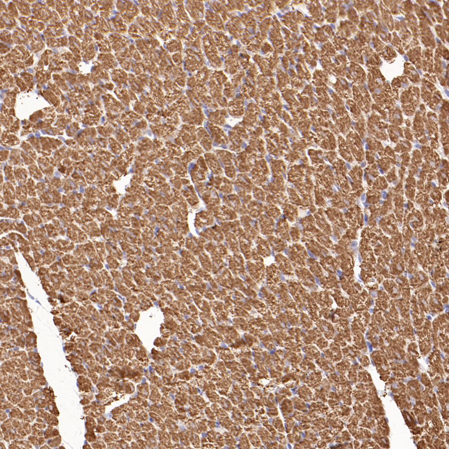 Myosin Light Chain 2/MLC-2V Rabbit Polyclonal Antibody