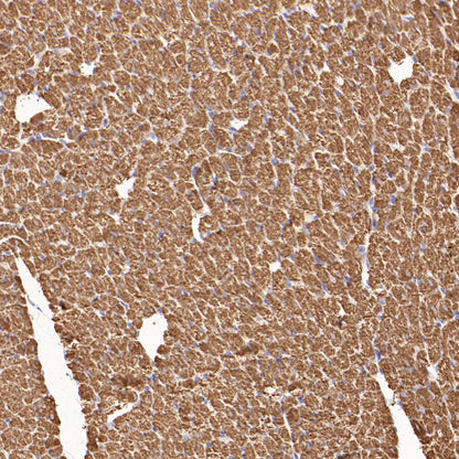 Myosin Light Chain 2/MLC-2V Rabbit Polyclonal Antibody