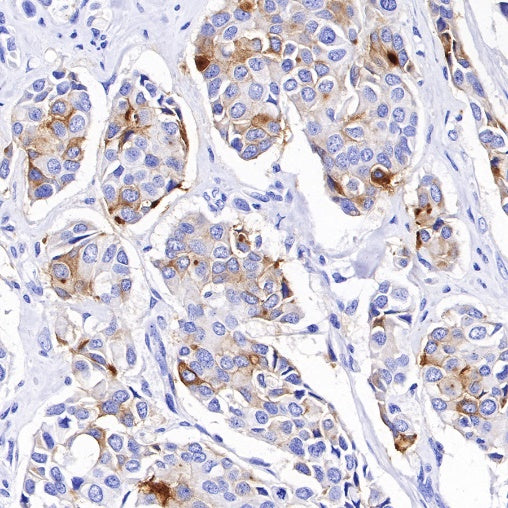 B7-H4 Recombinant Rabbit mAb (SDT-314-447-2)