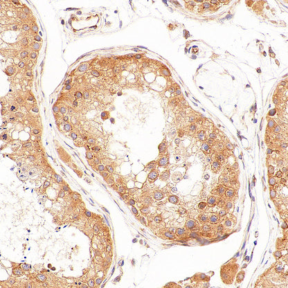 EIF2S2 Rabbit Polyclonal Antibody