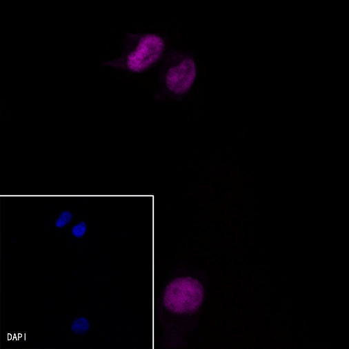 Progesterone Receptor Recombinant Rabbit mAb (Alex Fluor®647 Conjugate) (S-R123)
