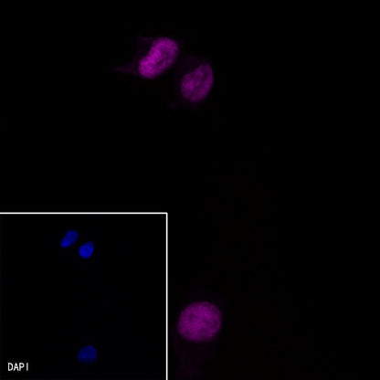 Progesterone Receptor Recombinant Rabbit mAb (Alex Fluor®647 Conjugate) (S-R123)