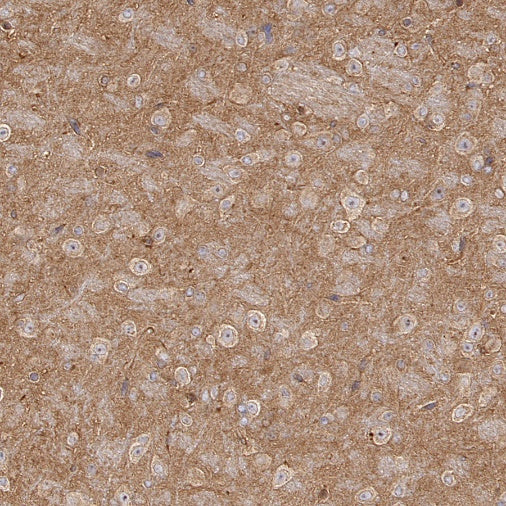 Src Recombinant Rabbit mAb (S-1181-16)