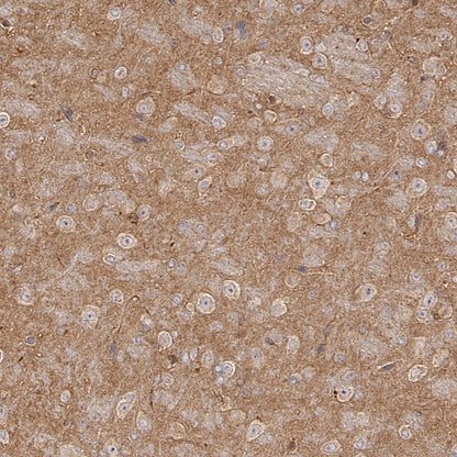 Src Recombinant Rabbit mAb (S-1181-16)