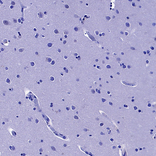Coagulation factor V Recombinant Rabbit mAb (S-4489-58)