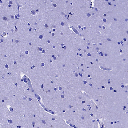 Coagulation factor V Recombinant Rabbit mAb (S-4489-58)