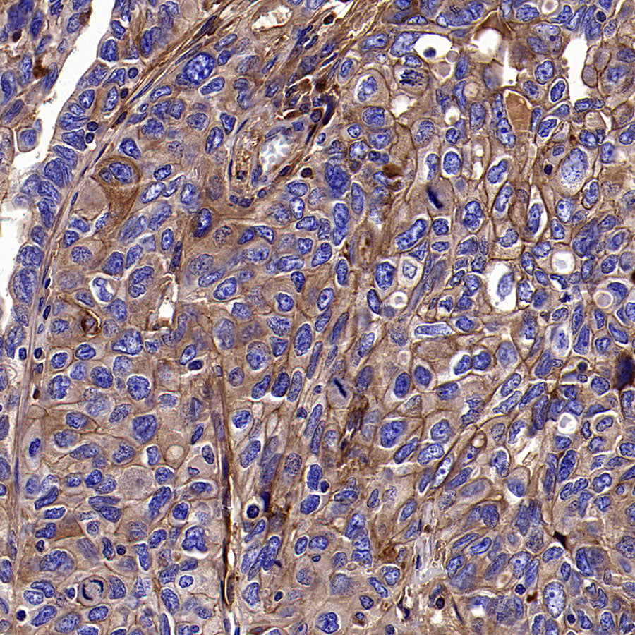 PTK7 Recombinant Rabbit mAb ,PBS Only(SDT-2432-136)