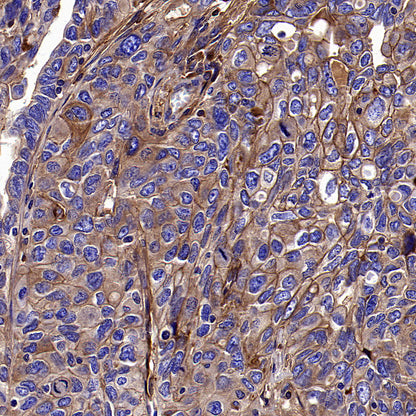 PTK7 Recombinant Rabbit mAb ,PBS Only(SDT-2432-136)